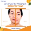 Neoprosone Crema Despigmentante Facial Corporal Vitamina Ácido Hialurónico Antipigmento Aclarante