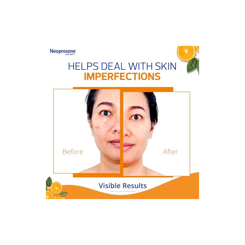Neoprosone Crema Despigmentante Facial Corporal Vitamina Ácido Hialurónico Antipigmento Aclarante
