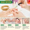 JAYSUING 【Buy 1 Get 1 Free】JAYSUING Ginger Nail CareSerum, Moisturizes,