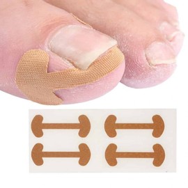 Toenail Band 4P Toenail Correction Tape Toenail Care Tape Claw protection band 6ea