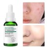 Sérum Facial Con Ácido Salicílico, Reduce Los Poros Y Contro