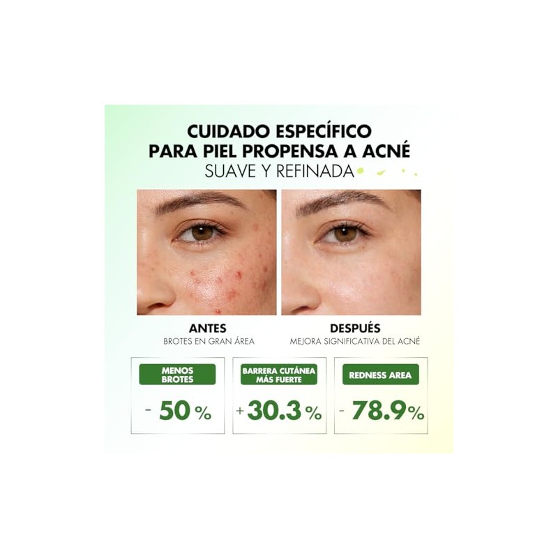 Sérum Facial Hidratante con Tea Tree, Fórmula Ligera y Suave