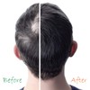 ORGANIC HAIR ENERGIZER HAIR GROWTH BOOSTER WITH PRO VITAMIN -