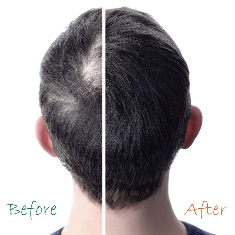 ORGANIC HAIR ENERGIZER HAIR GROWTH BOOSTER WITH PRO VITAMIN -