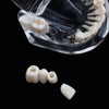 Modelo de dientes, modelo de práctica de enseñanza de dientes