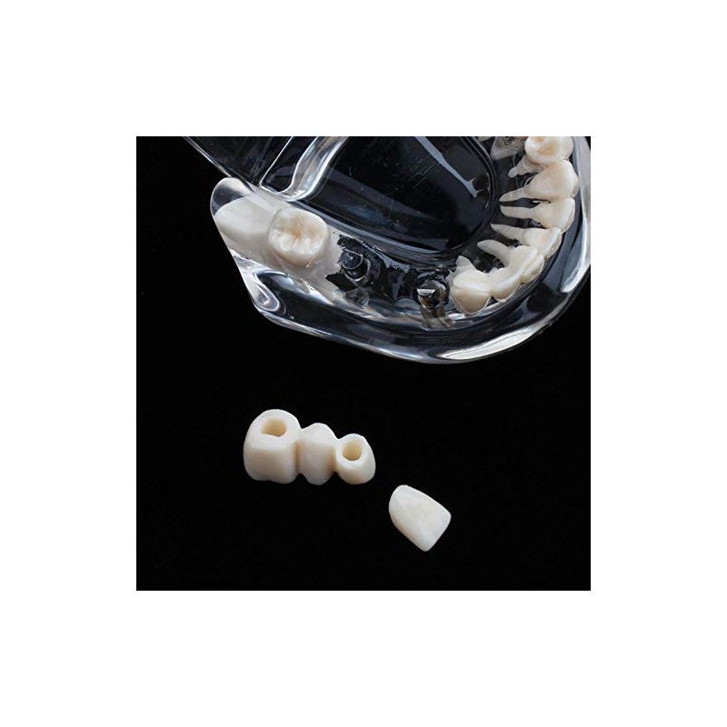 Modelo de dientes, modelo de práctica de enseñanza de dientes