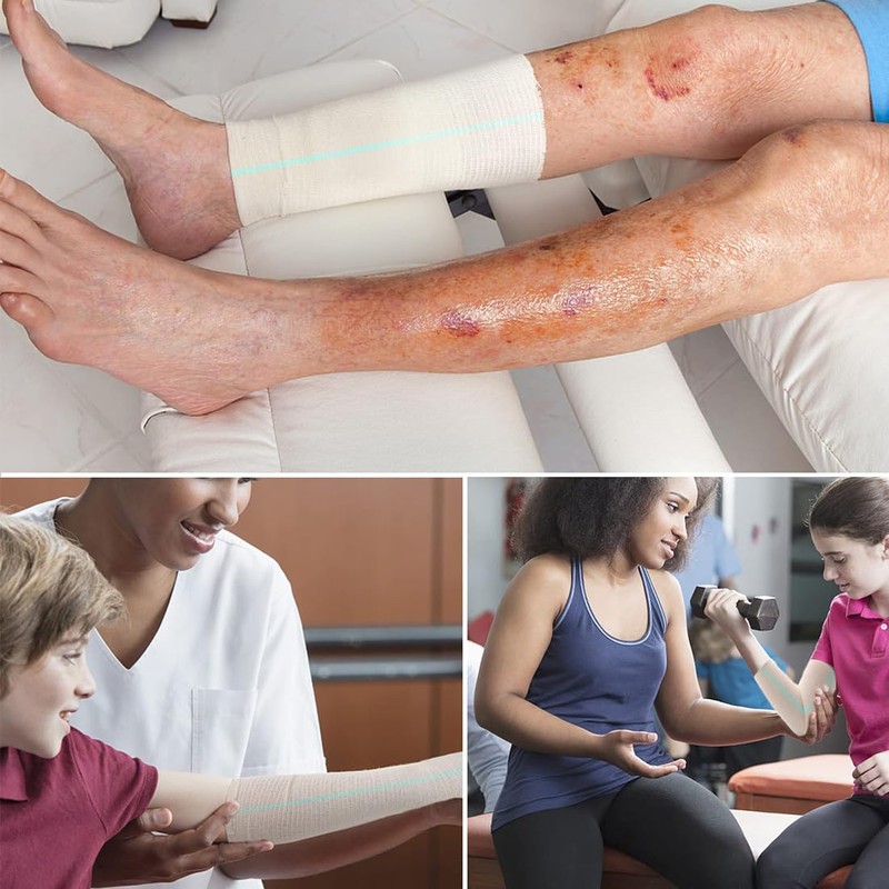 Tubular Bandage Elasticated Tubular Bandages Washable Support Sprain Bandage Conforming