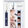 Ear Wax Removal Tool Camera - Safe and Effective Ear