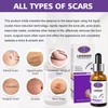 AICHUN BEAUTY Scars Repair Essence Lavender Extract Essential Oil Anti