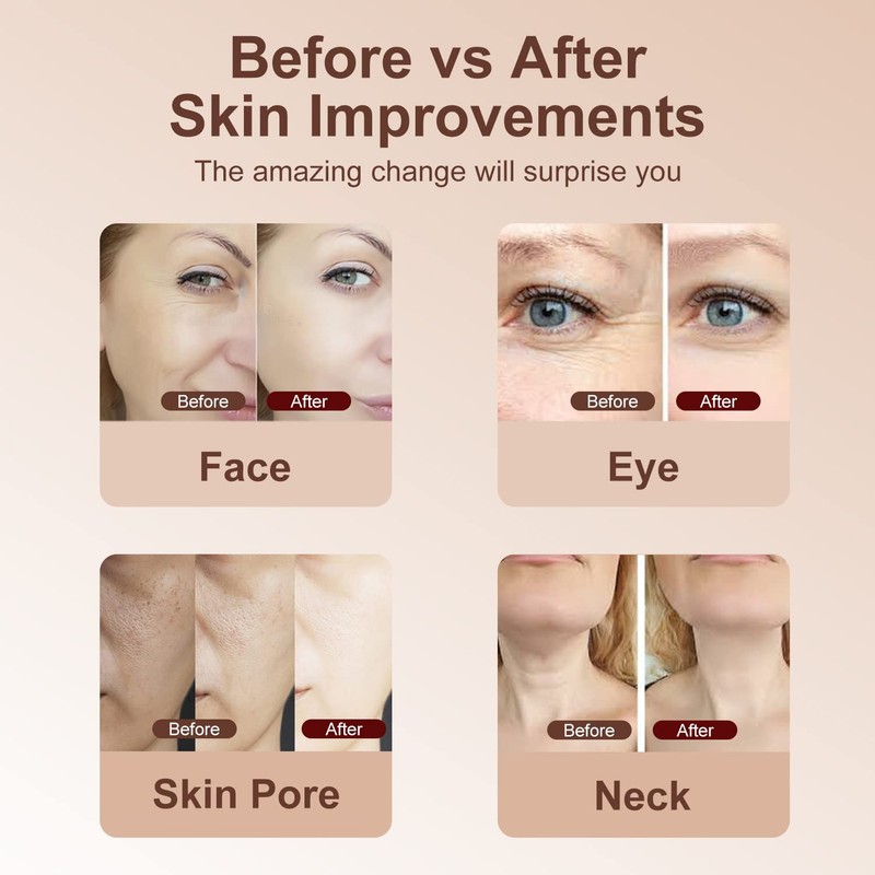 MiSMON 5 in 1 Micro-current Light Photontherapy Device