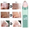 Multi Function Electric Vacuum Nasal Aspirator Suction Blackhead Cleansing Machine(Green