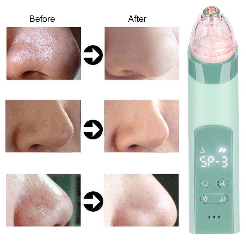 Multi Function Electric Vacuum Nasal Aspirator Suction Blackhead Cleansing Machine(Green