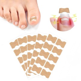 Ingrown Toenail Corrector Strips Toenail Correction Patch 50 Pcs Nail Strips Ingrown Toenail Treatment Paronychia Toe Nail Fixer Brace Foot Care Tool Kit for Toe Nail Fingernail Care