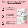 Weud Tratamiento Acné De Loción Seca Ácido Salicílico 29ml*2
