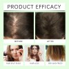 Batana Oil Shampoo, Shampoo De Batana, Rosemary Oil Shampoo