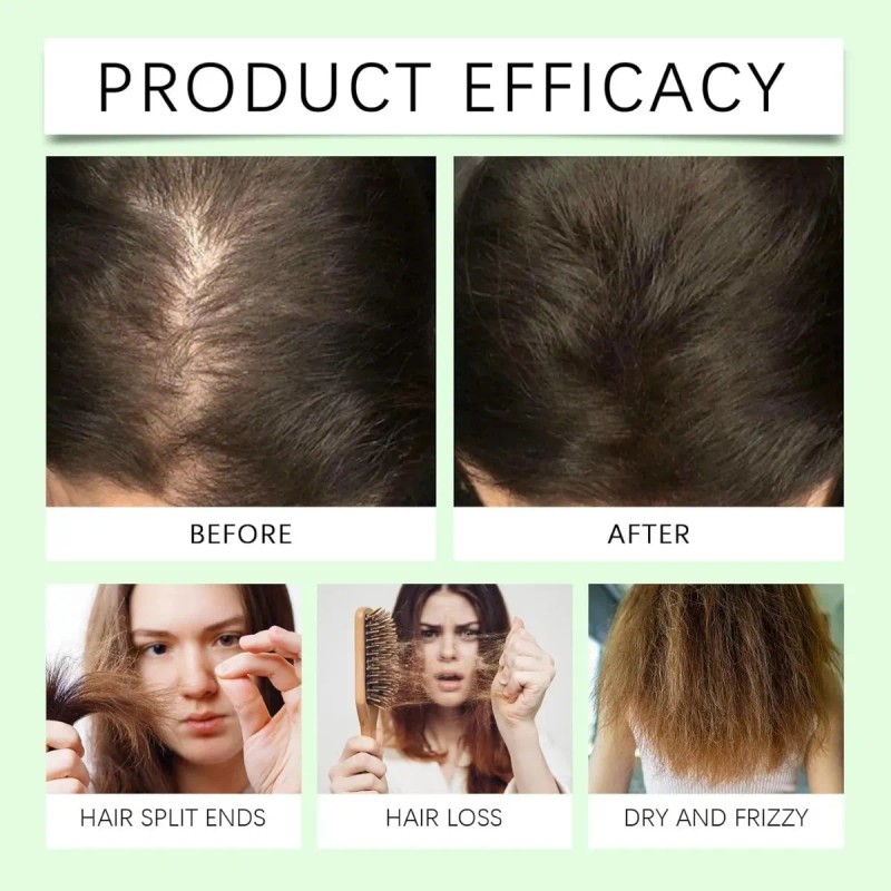 Batana Oil Shampoo, Shampoo De Batana, Rosemary Oil Shampoo