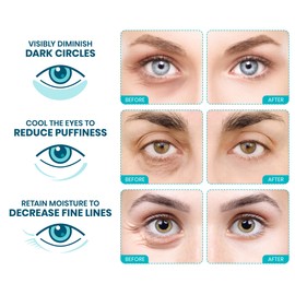 Stylia Stylia Under Eye Patches for Dark Circles and Puffy Eyes (12 Pairs), Marine Collagen Mask with Vitamin C, Hyaluronic Acid, Pearl Extract, Eye Masks for Dark Circles and Puffiness, Gifts for Women