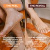 Foot Peel Mask - Pack Size: 2 Pairs Exfoliating Treatment