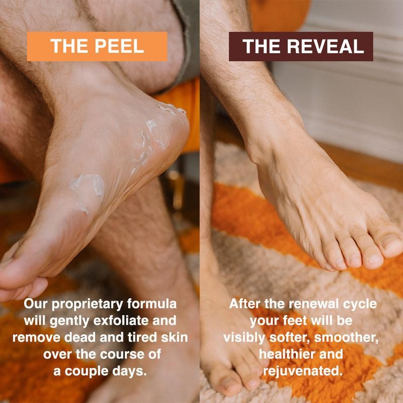 Foot Peel Mask - Pack Size: 2 Pairs Exfoliating Treatment