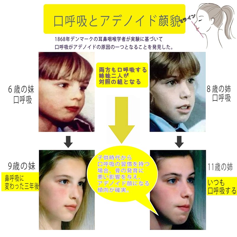 口閉じテープ 口呼吸防止テープ 鼻呼吸テープ アデノイド顔貌避け 喉の乾燥防止 鼻呼吸促進 睡眠改善 口呼吸対策 20日分