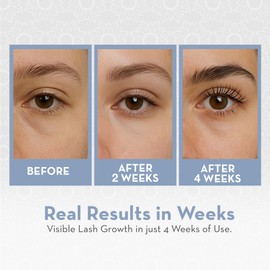 Pure Body Naturals Castor Oil for Eyelashes and Eyebrows - 1 Fl Oz Nourishing Brow & Lash Growth Serum - Organic, Hexane Free, Cold Pressed, Unrefined - Eyelash and Eyebrow Growth Serum for Women