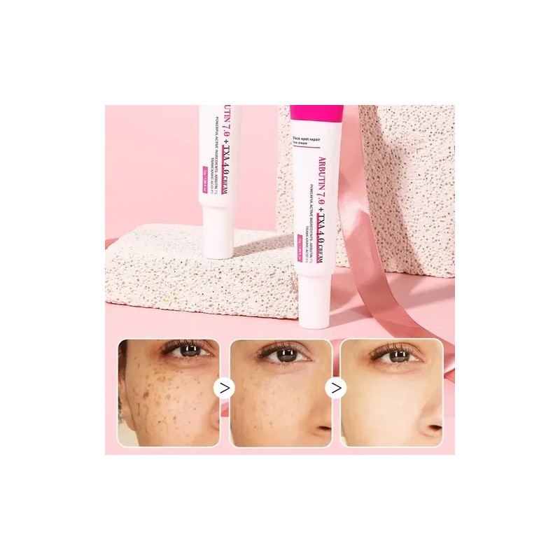 Crema Facial Antimanchas Antimanchas Melasma Paño 30 G