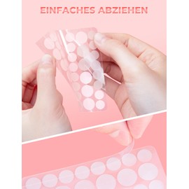 Unsichtbare pickel patch - Hydrokolloid pflaster wasserdicht & atmungsaktiv, starke absorption, rückstandsfrei, akne behandlung (10MM &12MM, 360 pimple patches)