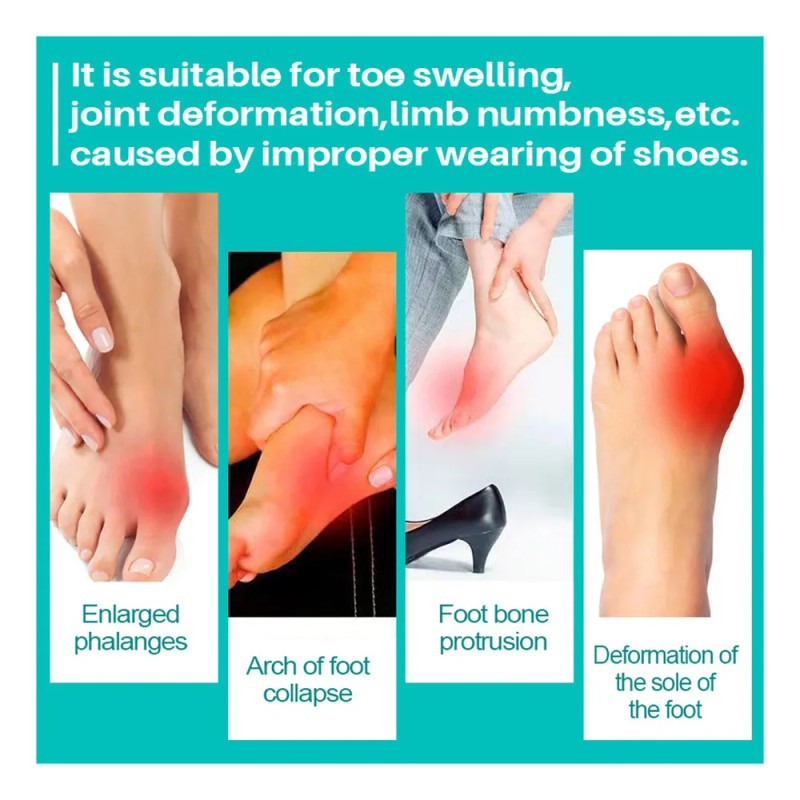 A Pomada Para El Dolor Del Juanete B Pomada Para