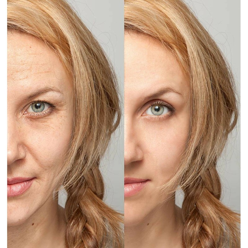 Dermactin-TS Line Eraser 90 Sec Wrinkle Reducer .34 oz. (VALUE