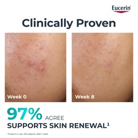 Eucerin Dermopure Clinical Peeling 10 Treatment 40ml, Renewing Facial Serum with 10% Dermo-Acids and Salicylic Acid, Exfoliating Serum for Oily, Blemish-Prone Skin