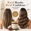 1PCSZova Hair Growth Balm,Deep Scalp Nourishing Hair Treatment