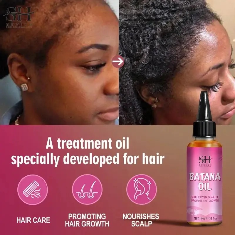 Aceite Para El Cabello Batana Pure 100% Growth Batana Africa