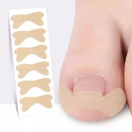 내성발톱 밴드 발톱보호 교정테이프 30개입 Ingrown Toenail Correction Tape 30ea [Ingrown Toenail Correction Band 30 pieces]