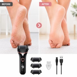 Electric Callus Remover for At-Home Pedicure – 2-Speed Rechargeable Foot File Kit with LCD Display