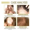 60ml*3 Aceite Vegano Natural Para El Crecimiento Del Cabello