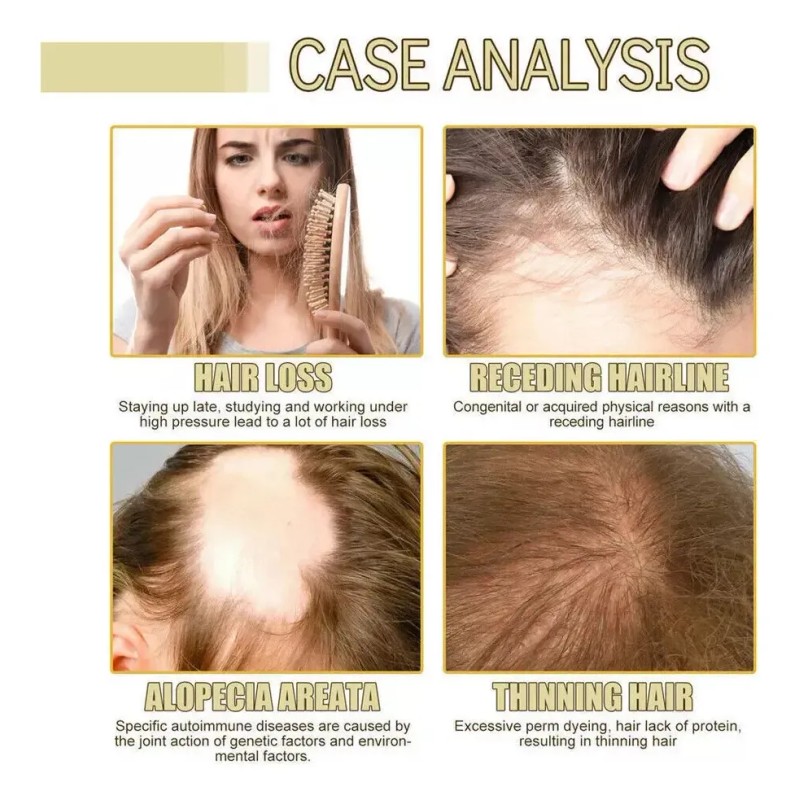 60ml*3 Aceite Vegano Natural Para El Crecimiento Del Cabello