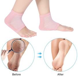 Calcetines de Talón de Gel Suave Calcetines Abiertos de Dedos para Piel Agrietada Dura Seca Piel Hidratante de Cuidado Nocturno(rosa)