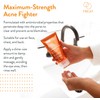 AcneFree Severe Acne 10% Benzoyl Peroxide Foaming Cleansing Wash, 5