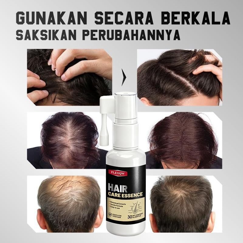 FLEXQW Hair Care Essence, Botanical Extracts Hair Growth Spray, Frizz