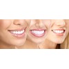 ShopINess Pack of Replacement Brush Heads Compatible - Sensiflex (Pack