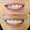 Instant Smile Comfort Fit Flexible Lower Teeth