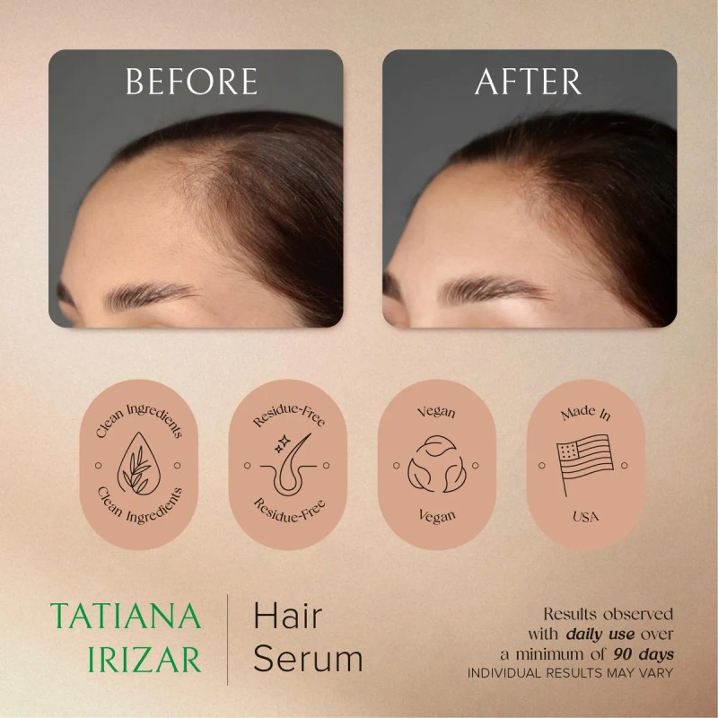 Sérum Para El Crecimiento Del Cabello Tatiana Irizar Para Mu
