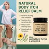 Body Cream for Itchy Skin – Natural Herbal Balm |