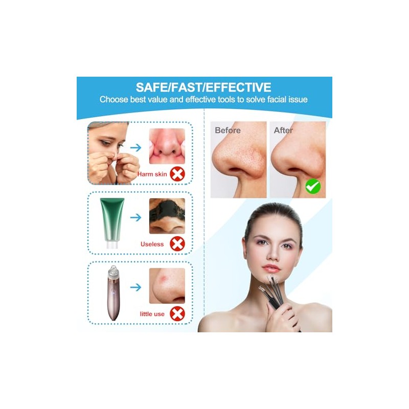 UWOIST Herramientas Para Eliminar Puntos Negros, Kit De Herramientas Para