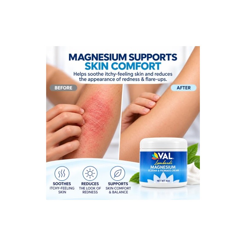 VAL “Val Zechstein Fórmula De Cloruro De Magnesio, Eczema, Psoriasis,