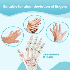 DrFinger Finger Ulnar Deviation Splint Brace, Finger Joint Deviation Orthopedic Corrector With Metal Bracket-Black-(Left-M)