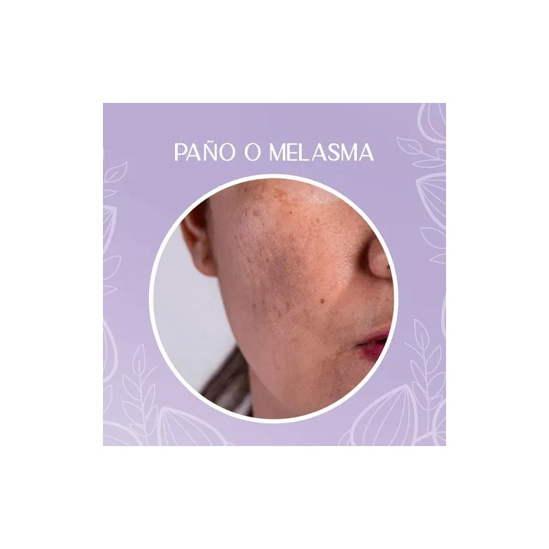 Crema Despigmentante Para Manchas, Melasma, Acné Y Paño