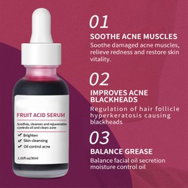 Pemarlis Aufhellendes Serum zur Entfernung dunkler Flecken, korrigierendes Serumöl für Gesicht und Körper zur Aufhellung dunkler Flecken, natürliches aufhellendes Öl zur Behandlung von Akne- und(5)