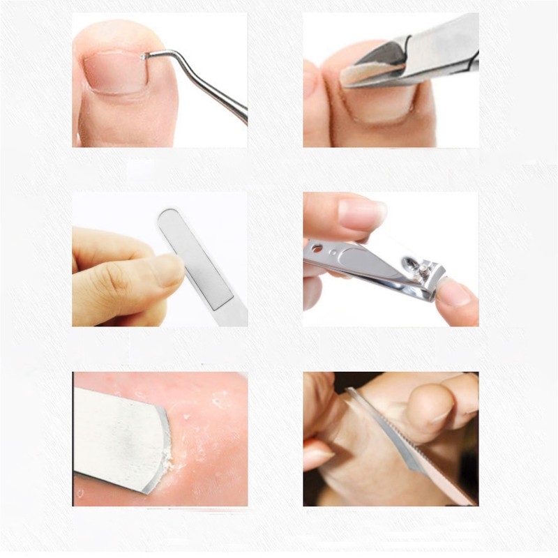 8Pcs Pedicure Knife Stainless Steel Dead Skin Remover Portable Foot