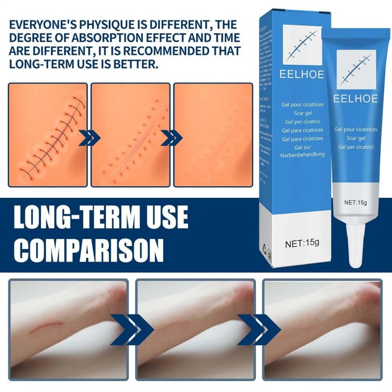 Gel Para El Cuidado De Cicatrices, Probado Por Dermatólogos,